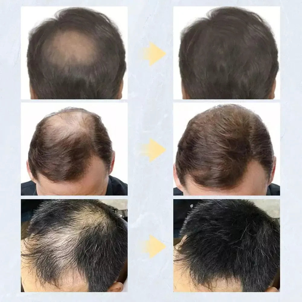 Toppik
Toppik Hair
Toppik Hair Fiber
Fibra Capilar
